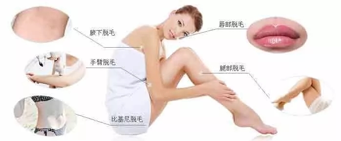 OPT冰点脱毛常见几大问题答疑？